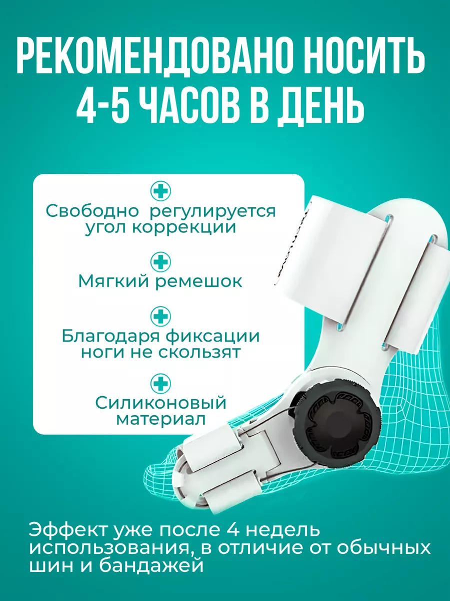 Вальгусная шина